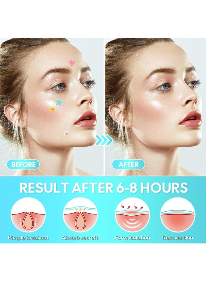 Star Pimple Patches For Face Hydrocolloid, 280Patches, Hydrocolloid Acne Patch, Cute Star Pimple Patch - Image 4